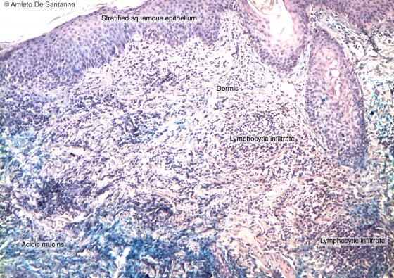 Figure C141A. Human skin