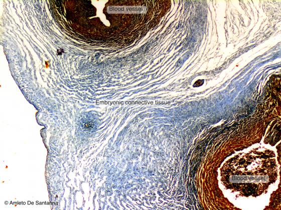 Figure C2. Human umbilical cord