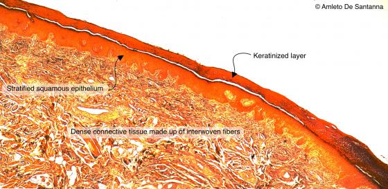 Figure C30. Human skin