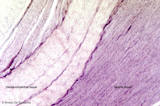 Figure C42. Human tendon