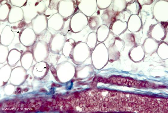 Figura C45. Mandibola di feto umano