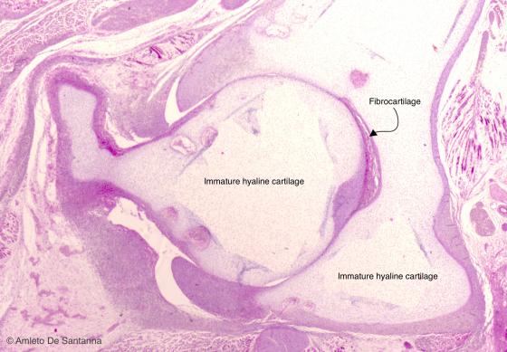 Figure C53. Human fetal coxofemoral joint