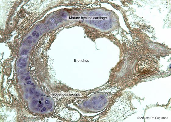 Figure C58. Dolphin lung