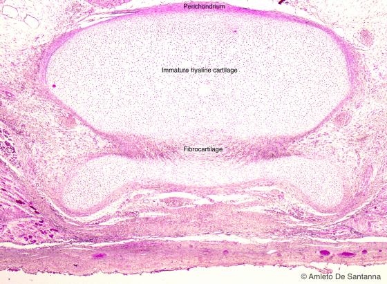 Figure C62. Human fetal vertebra