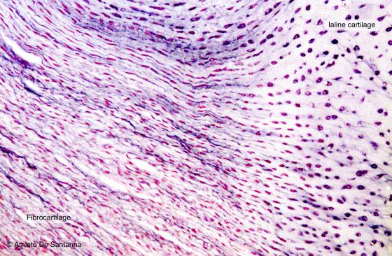 Figure C64. Human intervertebral disc