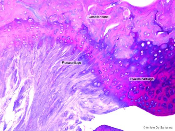 Figure C66A. Human fetal femur