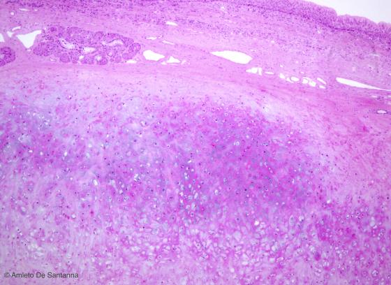 Figura C67. Epiglottide umana