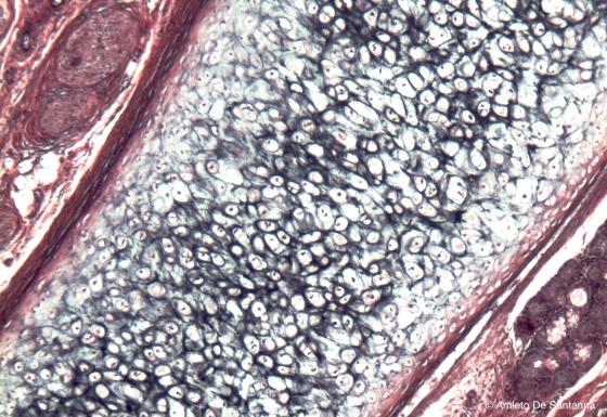 Figura C69. Epiglottide umana