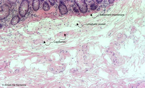 Figure C7. Human large intestine