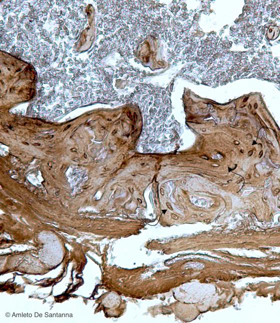 Figura C79. Femore di topo a più forte ingrandimento