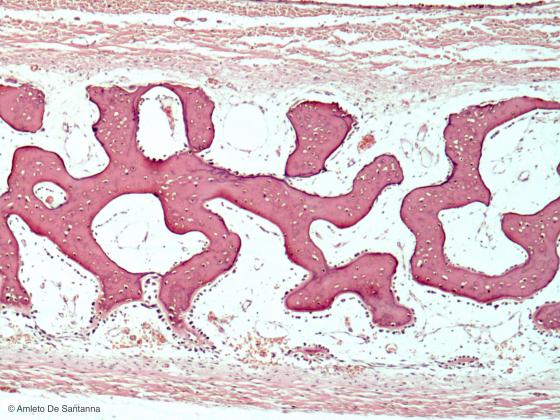 Figura C82. Cranio di feto umano