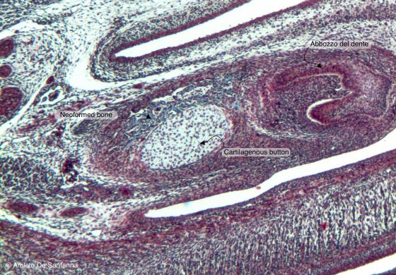 Figure C87. Mouse fetal mandible