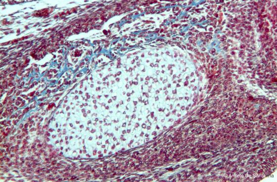 Figura C88. Mandibola di feto di topo a più forte ingrandimento