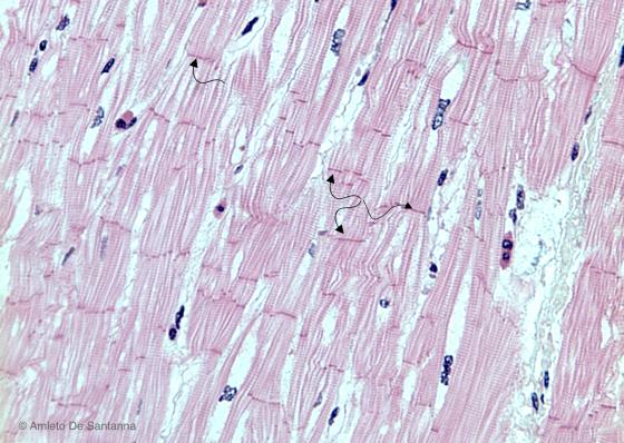 Figura M19. Tessuto muscolare striato cardiaco umano