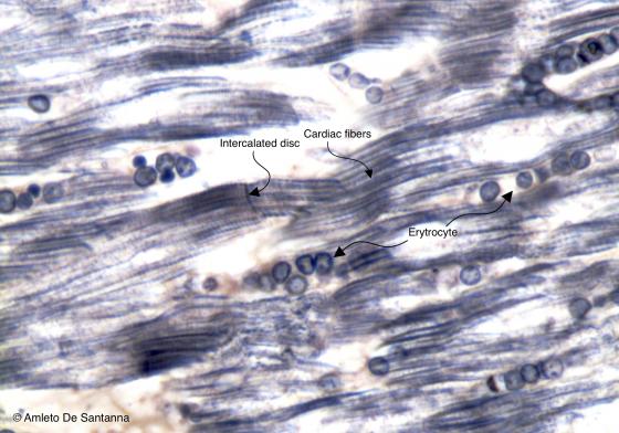 Figure M20. Human cardiac muscle tissue