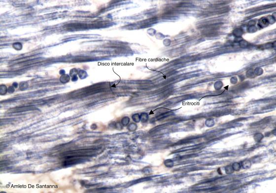 Figura M20. Tessuto muscolare striato cardiaco umano a forte ingrandimento