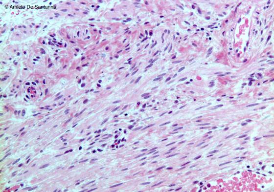 Figura M24. Tuba uterina umana a più forte ingrandimento