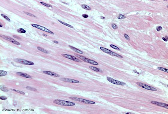 Figura M27. Tonaca muscolare di intestino umano