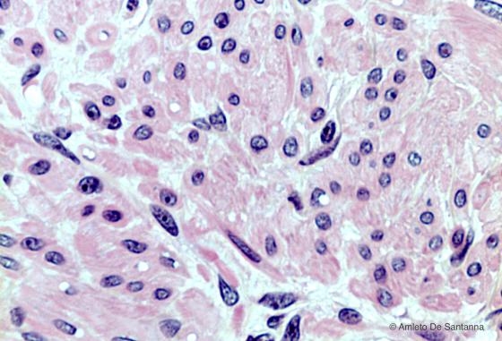 Figura M28. Tonaca muscolare di intestino umano