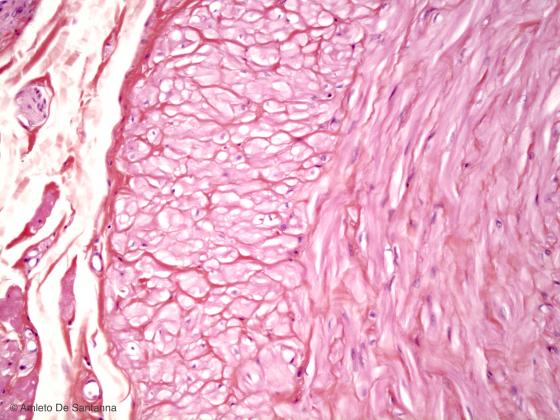 Figura M31. Dotto deferente umano a più forte ingrandimento