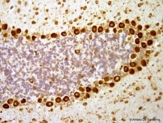Figura N13. Cervelletto di topo