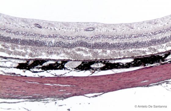 Figura N21B. Bulbo oculare di uomo