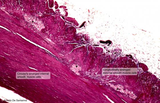 Figure N40. Human gut