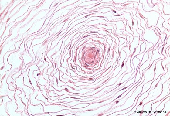 Figura N56. Corpuscolo di Pacini a più forte ingrandimento