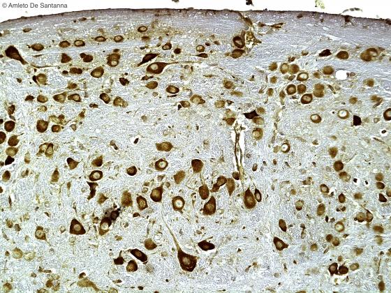 Figura N6. Corteccia telencefalica di topo