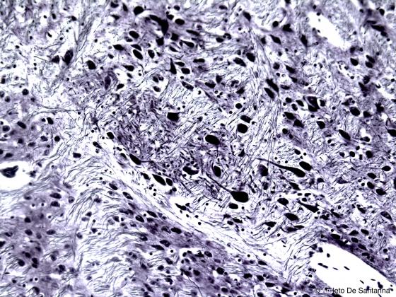 Figuta N9. Corteccia telencefalica umana